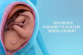 3D动画带你科普剖腹产手术全过程，致敬伟大的母亲！视频封面