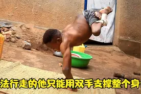 男孩从出生起就只有半截身体 他是怎样活下来的视频封面