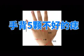 手背5颗不好的痣，千万要点掉！视频封面