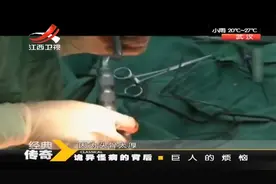 河南小村诞生一巨人，16岁竟长到2米46，爸妈竟都是普通人视频封面