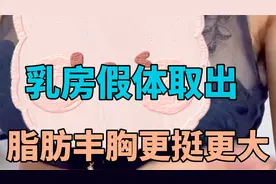 胸部更挺翘了，乳房假体取出，同期脂肪丰胸视频封面