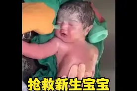 医生全力抢救，新生宝宝，大家看到最后情况怎么样？视频封面