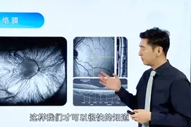 眼底照相和oct，近视防控的重要检查！