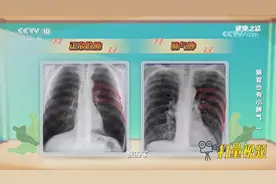 正常的肺和出现肺气肿的肺有何区别？来看看这组对比照片了解下