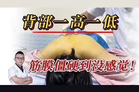 背部硬如木板、沉！紧！使劲按才舒服！筋膜炎有苦说不出