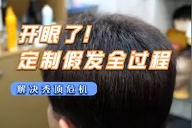 开眼了，定制假发的全制作过程，解决秃顶危机
