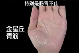 太阳丘上太阳线见杂纹干扰，说明难遇贵人帮扶，靠自己单打独斗