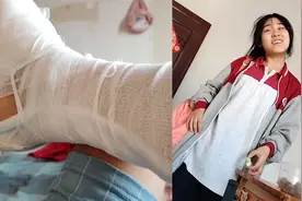 女儿回家看到爸爸受伤，得知少了一根脚趾瞬间变脸哭泣视频封面