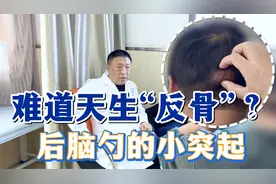 快摸摸后脑勺 有没有硬硬的小突起 难道这就是传说中的反骨？