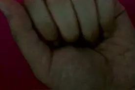 后溪穴的定位及主治