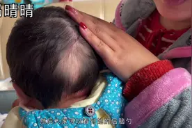 小宝宝出现了枕秃的现象是缺钙吗？不用担心，这是成长的必经之路