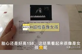 孕37+6最后一次B超检查，看结果好像是女孩👧哦