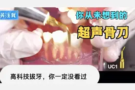 超声骨刀拔牙操作流程和方法，不仅可以拔牙还可以剥鸡蛋🥚视频封面