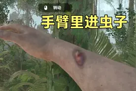 绿色地狱前传4:手臂里进虫子了