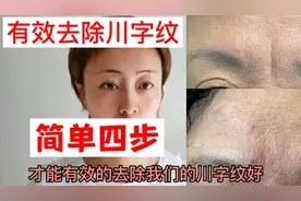 川字纹太丑了，简单四步去除难搞的眉间纹。效果太好了