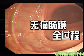 无痛肠镜全过程，真的没有那么可怕！
