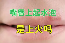 嘴唇上起水泡是上火吗？中西医不同的解释，最后的治疗完全不同！视频封面