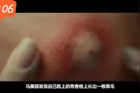 一根毛很可能要了你的命