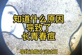 知道为什么爱长青春痘吗？用显微镜放大青春痘给大家看一下视频封面