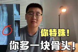 大夫嫌我太认真，没骨折能走路？复查结果我蒙了，为啥我还是疼？视频封面