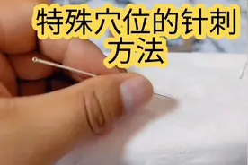 这些穴位这样刺才安全！供大家参考