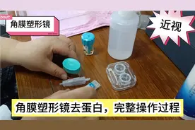 角膜塑形镜一个月去一次蛋白，看看我们去蛋白的操作方法
