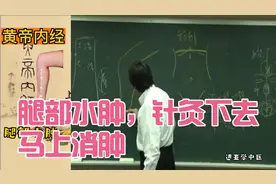 倪海厦老师讲解腿部水肿，针灸下去立马见效