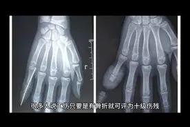 怎么才是工伤十级呢视频封面