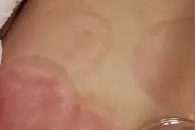 碧波庭氧离子拔罐，疏通经络、减肥塑身、增强心肺、提高免疫力等视频封面