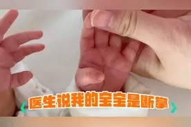 医生说宝宝是通贯掌 原来断掌还有这个说法 吓坏宝妈