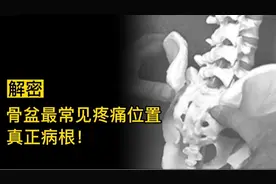 骨盆处最常见疼痛位置真正病根，为您解密！曹修行原发点疗法掌门视频封面