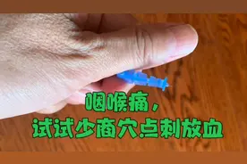 感染病毒后的咽喉痛，不妨试试少商穴的点刺放血，简便易行疗效好视频封面