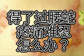 带状疱疹（过腰蛇）🐍疼痛难忍，坐立不安，怎么办？
