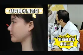 女模特多次隆鼻后成“猪鼻子”，希望这次能上岸！视频封面