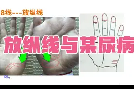 放纵线：提示长期生活不规律、身体耗损、血唐问题