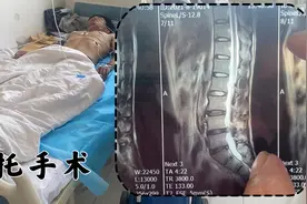 大哥腰间盘突出10多年，病痛的太严重，微创孔镜手术能治好么