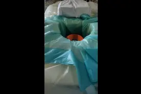 记录海扶刀手术治疗子宫肌瘤全过程#海扶刀