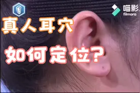 真人耳穴学习#中医#护理专业视频封面