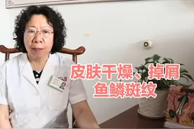 小腿掉皮像鱼鳞一样？1个中药方，擅长皮肤干燥、掉屑、蛇皮腿！视频封面