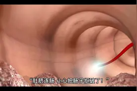 肚脐连着肠子？不能轻易抠？这么多年真相终于清楚了…