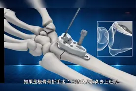 工伤休息多久去上班视频封面