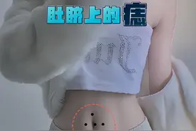 肚脐有痣 #痣的魅力#痣的含义#痣