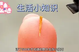 手心扎进木屑去，怎么取出？生活小妙招教你完胜生活小难题