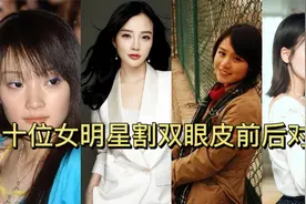 十位女明星割双眼皮前后大对比