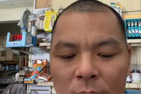 体验一次自己动手拔牙第一次听说很可怕😱😂😂😂其实没那么可怕！