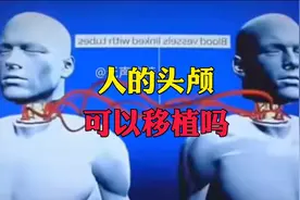 人的头颅可以移植吗，意大利医学家解密真相，科幻片即将成为现实视频封面
