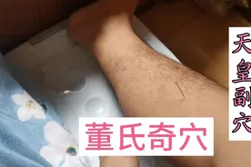 董氏奇穴下三皇位置，下三皇很强大，养生保健要穴，很值得学习