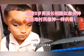 印度小男孩长相奇特，被视作神灵膜拜信奉。视频封面