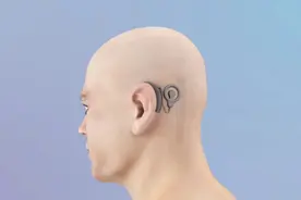 人工耳蜗的植入过程，3D演示。。视频封面