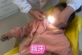 记录姐姐拔牙全过程，乳牙还没掉恒牙都快冒头了，只能让牙医拔了